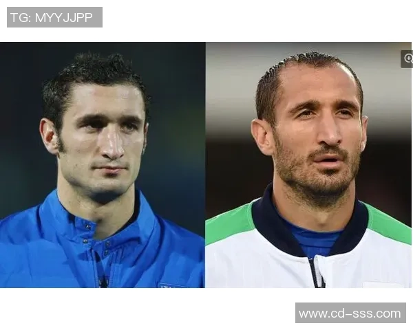 足球明星们的植发故事揭秘你不知道的那些球员经历